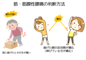 筋・筋膜性腰痛の判断方法